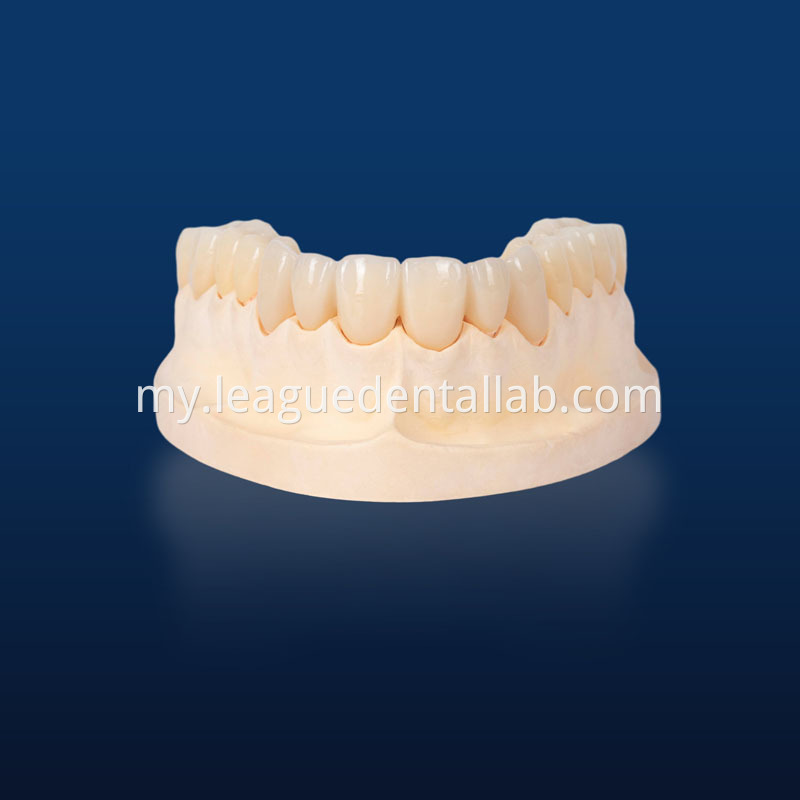 UTML zirconia,Katana zirconia,Esthetic zirconia,SHTML zirconia,3D Multilayered Zirconia